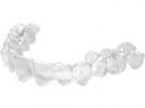 invisalign-1