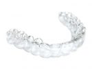 invisalign-2 invisalign-2